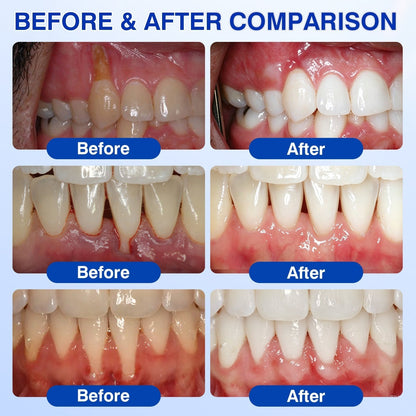 🏅🦷𝐎𝐟𝐟𝐢𝐜𝐢𝐚𝐥 𝐒𝐭𝐨𝐫𝐞 | 𝐃𝐫.𝐄𝐫𝐚® 𝐆𝐮𝐦𝐑𝐞𝐯𝐢𝐯𝐞 𝐏𝐞𝐫𝐢𝐨𝐝𝐨𝐧𝐭𝐚𝐥 𝐑𝐞𝐩𝐚𝐢𝐫 𝐆𝐞𝐥 — 𝐓𝐚𝐫𝐠𝐞𝐭𝐞𝐝 𝐆𝐮𝐦𝐥𝐢𝐧𝐞 𝐒𝐮𝐩𝐩𝐨𝐫𝐭 𝐟𝐨𝐫 𝐏𝐥𝐚𝐪𝐮𝐞, 𝐂𝐚𝐯𝐢𝐭𝐢𝐞𝐬, 𝐏𝐞𝐫𝐢𝐨𝐝𝐨𝐧𝐭𝐚𝐥 𝐂𝐨𝐧𝐜𝐞𝐫𝐧𝐬, 𝐁𝐚𝐝 𝐁𝐫𝐞𝐚𝐭𝐡 & 𝐖𝐞𝐚𝐤 𝐓𝐞𝐞𝐭𝐡 | 𝐏𝐫𝐞𝐜𝐢𝐬𝐢𝐨𝐧 𝐋𝐞𝐚𝐯𝐞-𝐎𝐧 𝐎𝐫𝐚𝐥 𝐂𝐚𝐫𝐞 𝐅𝐨𝐫𝐦𝐮𝐥𝐚