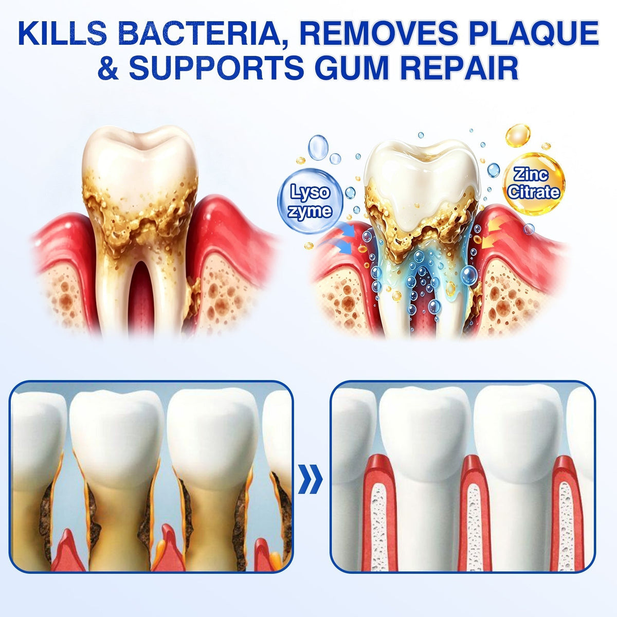 🏅🦷𝐎𝐟𝐟𝐢𝐜𝐢𝐚𝐥 𝐒𝐭𝐨𝐫𝐞 | 𝐃𝐫.𝐄𝐫𝐚® 𝐆𝐮𝐦𝐑𝐞𝐯𝐢𝐯𝐞 𝐏𝐞𝐫𝐢𝐨𝐝𝐨𝐧𝐭𝐚𝐥 𝐑𝐞𝐩𝐚𝐢𝐫 𝐆𝐞𝐥 — 𝐓𝐚𝐫𝐠𝐞𝐭𝐞𝐝 𝐆𝐮𝐦𝐥𝐢𝐧𝐞 𝐒𝐮𝐩𝐩𝐨𝐫𝐭 𝐟𝐨𝐫 𝐏𝐥𝐚𝐪𝐮𝐞, 𝐂𝐚𝐯𝐢𝐭𝐢𝐞𝐬, 𝐏𝐞𝐫𝐢𝐨𝐝𝐨𝐧𝐭𝐚𝐥 𝐂𝐨𝐧𝐜𝐞𝐫𝐧𝐬, 𝐁𝐚𝐝 𝐁𝐫𝐞𝐚𝐭𝐡 & 𝐖𝐞𝐚𝐤 𝐓𝐞𝐞𝐭𝐡 | 𝐏𝐫𝐞𝐜𝐢𝐬𝐢𝐨𝐧 𝐋𝐞𝐚𝐯𝐞-𝐎𝐧 𝐎𝐫𝐚𝐥 𝐂𝐚𝐫𝐞 𝐅𝐨𝐫𝐦𝐮𝐥𝐚