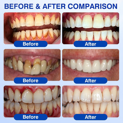 🏅🦷𝐎𝐟𝐟𝐢𝐜𝐢𝐚𝐥 𝐒𝐭𝐨𝐫𝐞 | 𝐃𝐫.𝐄𝐫𝐚® 𝐆𝐮𝐦𝐑𝐞𝐯𝐢𝐯𝐞 𝐏𝐞𝐫𝐢𝐨𝐝𝐨𝐧𝐭𝐚𝐥 𝐑𝐞𝐩𝐚𝐢𝐫 𝐆𝐞𝐥 — 𝐓𝐚𝐫𝐠𝐞𝐭𝐞𝐝 𝐆𝐮𝐦𝐥𝐢𝐧𝐞 𝐒𝐮𝐩𝐩𝐨𝐫𝐭 𝐟𝐨𝐫 𝐏𝐥𝐚𝐪𝐮𝐞, 𝐂𝐚𝐯𝐢𝐭𝐢𝐞𝐬, 𝐏𝐞𝐫𝐢𝐨𝐝𝐨𝐧𝐭𝐚𝐥 𝐂𝐨𝐧𝐜𝐞𝐫𝐧𝐬, 𝐁𝐚𝐝 𝐁𝐫𝐞𝐚𝐭𝐡 & 𝐖𝐞𝐚𝐤 𝐓𝐞𝐞𝐭𝐡 | 𝐏𝐫𝐞𝐜𝐢𝐬𝐢𝐨𝐧 𝐋𝐞𝐚𝐯𝐞-𝐎𝐧 𝐎𝐫𝐚𝐥 𝐂𝐚𝐫𝐞 𝐅𝐨𝐫𝐦𝐮𝐥𝐚