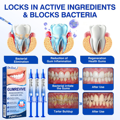 🏅🦷𝐎𝐟𝐟𝐢𝐜𝐢𝐚𝐥 𝐒𝐭𝐨𝐫𝐞 | 𝐃𝐫.𝐄𝐫𝐚® 𝐆𝐮𝐦𝐑𝐞𝐯𝐢𝐯𝐞 𝐏𝐞𝐫𝐢𝐨𝐝𝐨𝐧𝐭𝐚𝐥 𝐑𝐞𝐩𝐚𝐢𝐫 𝐆𝐞𝐥 — 𝐓𝐚𝐫𝐠𝐞𝐭𝐞𝐝 𝐆𝐮𝐦𝐥𝐢𝐧𝐞 𝐒𝐮𝐩𝐩𝐨𝐫𝐭 𝐟𝐨𝐫 𝐏𝐥𝐚𝐪𝐮𝐞, 𝐂𝐚𝐯𝐢𝐭𝐢𝐞𝐬, 𝐏𝐞𝐫𝐢𝐨𝐝𝐨𝐧𝐭𝐚𝐥 𝐂𝐨𝐧𝐜𝐞𝐫𝐧𝐬, 𝐁𝐚𝐝 𝐁𝐫𝐞𝐚𝐭𝐡 & 𝐖𝐞𝐚𝐤 𝐓𝐞𝐞𝐭𝐡 | 𝐏𝐫𝐞𝐜𝐢𝐬𝐢𝐨𝐧 𝐋𝐞𝐚𝐯𝐞-𝐎𝐧 𝐎𝐫𝐚𝐥 𝐂𝐚𝐫𝐞 𝐅𝐨𝐫𝐦𝐮𝐥𝐚